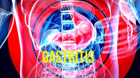 gastritis simptomi