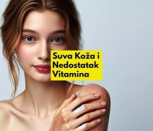 suva koža je i nedostatak vitamina