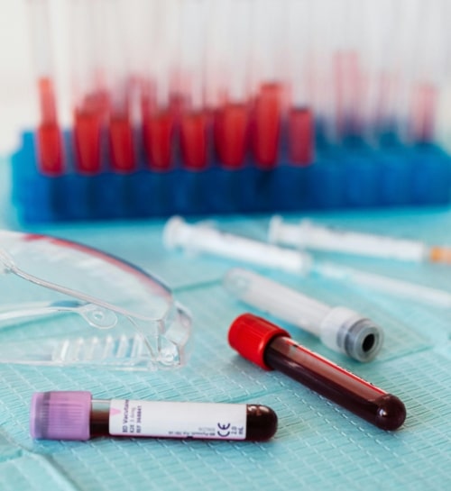 simptomi anemije kod žena